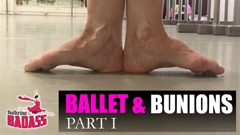 ballerina bunions nude